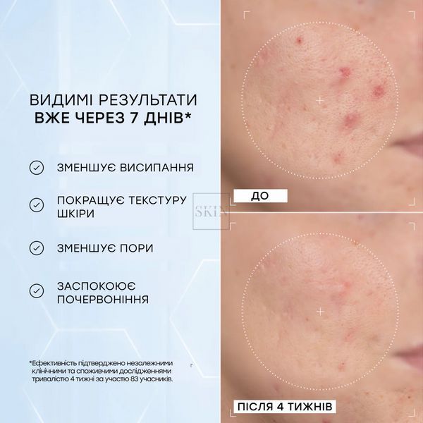 Сироватка з 10% ніацинамідом та пептидами Medik8 Niacinamide Peptides 30 ml 000049 фото