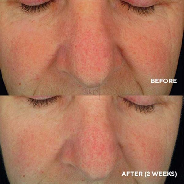 Успокаивающая сыворотка HydroPeptide Soothing Serum 30 ml 000647 фото
