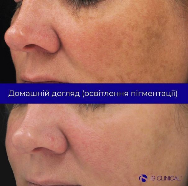 Набір для освітлення шкіри iS Clinical Pure Radiance Collection 000239 фото