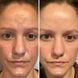 Укрепляющий концентрат для осветления и защиты кожи HydroPeptide Firma-Bright 30 ml 000653 фото 5