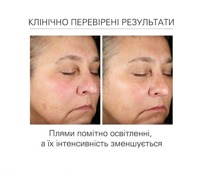 Помірно освітлюючий крем для шкіри ZO Skin Health Brightalive Skin Brightener 30 ml 000063 фото
