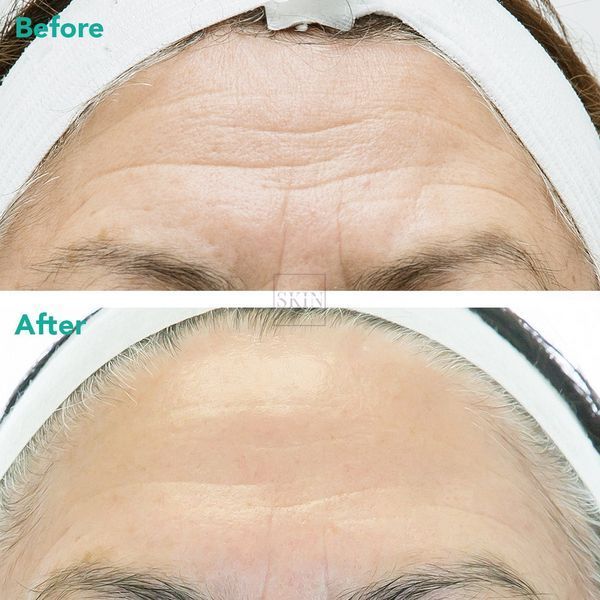 Омолаживающая сыворотка для лица с ретинолом и полинуклеотидами Rejuran Advanced Anti-Aging Retinol + c-PDRN&reg; Serum 30 ml 000400 фото