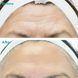 Омолаживающая сыворотка для лица с ретинолом и полинуклеотидами Rejuran Advanced Anti-Aging Retinol + c-PDRN&reg; Serum 30 ml 000400 фото 4