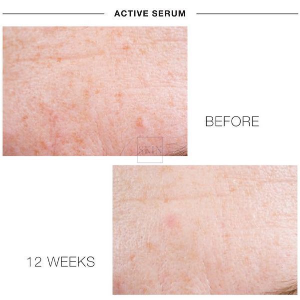 Многофункциональная сыворотка для кожи лица iS Clinical Active Serum 15 ml 000081 фото