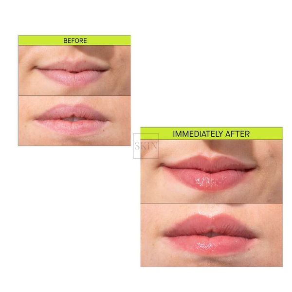 Засіб для зволоження та об'єму губ Transparent Lab Volume Hydro Plump Lip Augmentation 15 ml 000575 фото