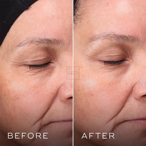 Отшелушивающий тоник с РНА и активатором ферментов Medik8 Press & Glow 30 ml 000044 фото