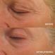 Интенсивный лифтинг-крем для век HydroPeptide Eye Authority 15 ml 000686 фото 4