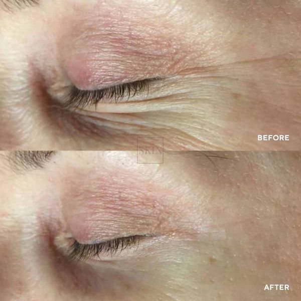 Патчі для зони навколо очей HydroPeptide PolyPeptide Collagel + Mask for eyes 8 шт 000688 фото